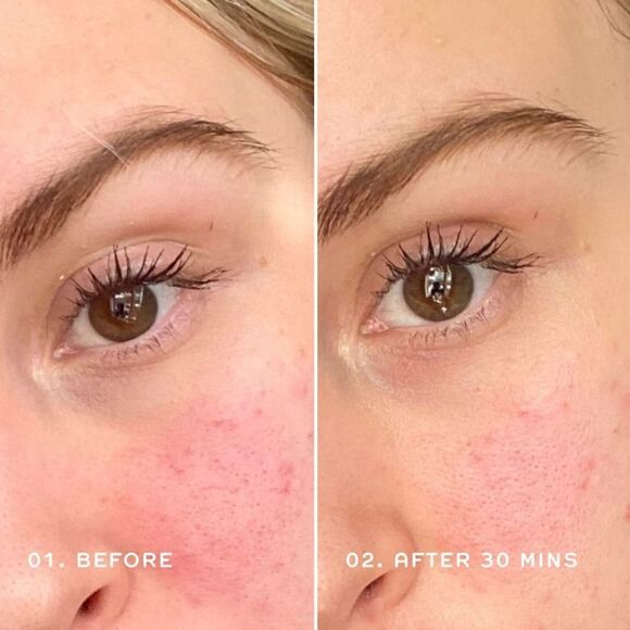 REN Redness Relief Soothing Serum - Picture 3 of 10